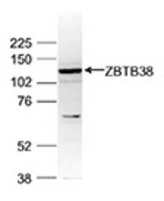 Western Blot: ZBTB38 Antibody [NBP3-18641] - Figure 2. Western blot analysis using the antibody directed against ZBTB38 Nuclear extracts of HeLa cells (40 ug) were analysed by Western blot using the antibody against ZBTB38 diluted 1:1,000 in TBS-Tween containing 5% skimmed milk. The position of the protein of interest (expected size: 138 kDa) is indicated on the right; the marker (in kDa) is shown on the left.