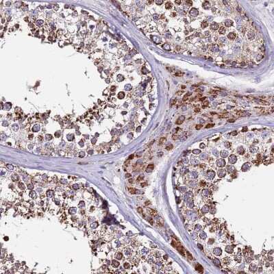 Immunohistochemistry-Paraffin: ZBTB39 Antibody [NBP2-13534] - Staining of human testis shows cytoplasmic positivity in cells in seminiferous ducts and Leydig cells.