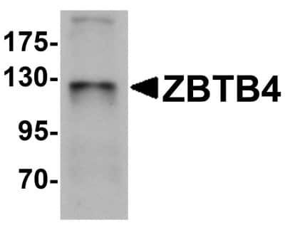 Western Blot: ZBTB4 Antibody [NBP1-76517] - SK-N-SH cell lysate with ZBTB4 antibody at 1 ug/mL.