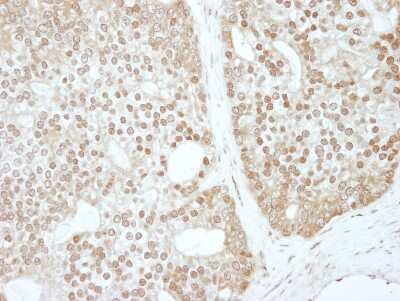 Immunohistochemistry ZBTB40 Antibody