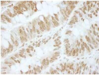 Immunohistochemistry-Paraffin ZBTB40 Antibody