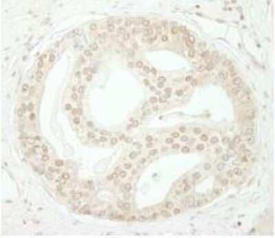 Immunohistochemistry-Paraffin ZBTB40 Antibody