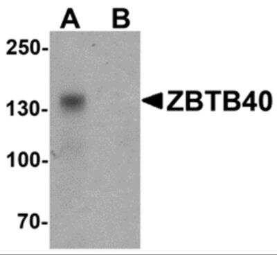Western Blot ZBTB40 Antibody - BSA Free