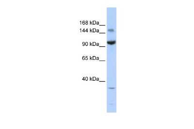 Western Blot ZBTB40 Antibody - BSA Free