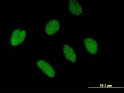 Immunocytochemistry/Immunofluorescence: ZBTB46 Antibody [H00140685-B01P] - Analysis of purified antibody to BTBD4 on HeLa cell. (antibody concentration 10 ug/ml)