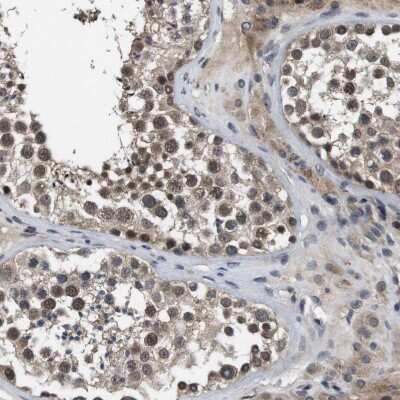 Immunohistochemistry-Paraffin: ZBTB46 Antibody [NBP1-88506] - Staining of human testis shows strong nuclear positivity in cells in seminiferous ducts.