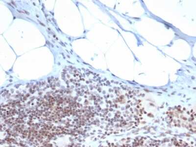 Immunohistochemistry-Paraffin: ZBTB46 Antibody (PCRP-ZBTB46-2B8) [NBP3-07755] - Formalin-fixed, paraffin-embedded human tonsil stained with ZBTB46 Mouse Monoclonal Antibody (PCRP-ZBTB46-2B8).