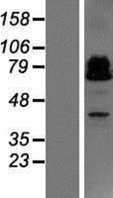 Western Blot: ZBTB46 Overexpression Lysate (Adult Normal) [NBP2-06207] Left-Empty vector transfected control cell lysate (HEK293 cell lysate); Right -Over-expression Lysate for ZBTB46.