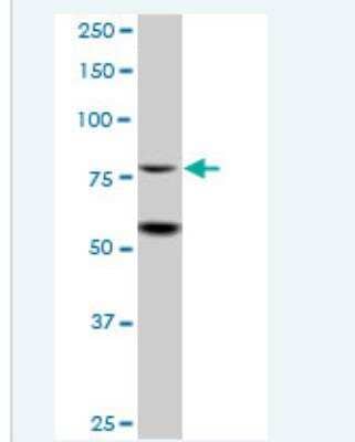 Western Blot ZBTB48 Antibody - Azide and BSA Free