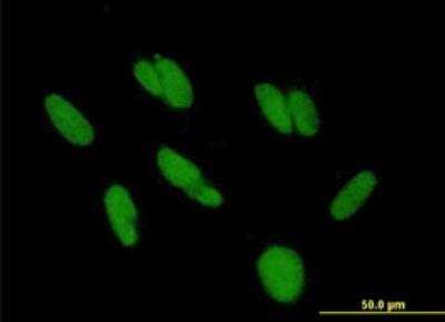 Immunocytochemistry/Immunofluorescence: ZBTB48 Antibody [H00003104-B01P-50ug] - Purified MaxPab antibody to HKR3 on HepG2 cell. [antibody concentration 10 ug/ml]