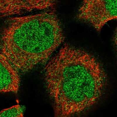 Immunocytochemistry/ Immunofluorescence ZBTB48 Antibody - BSA Free
