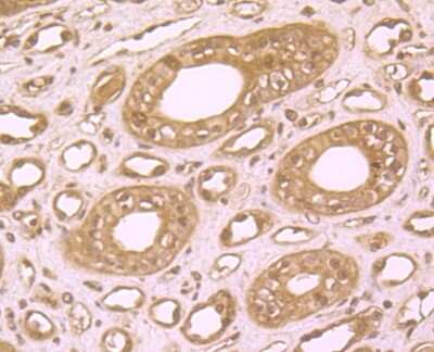 Immunohistochemistry-Paraffin: ZBTB48 Antibody [NBP2-75720] - Analysis of paraffin-embedded human kidney tissue using anti-ZBTB48 antibody. Counter stained with hematoxylin.
