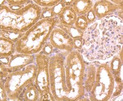 Immunohistochemistry-Paraffin: ZBTB48 Antibody [NBP2-75720] - Analysis of paraffin-embedded rat kidney tissue using anti-ZBTB48 antibody. Counter stained with hematoxylin.