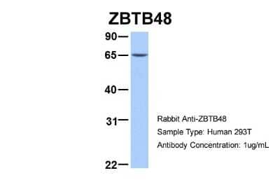 Western Blot: ZBTB48 Antibody [NBP2-88607] - Host: Rabbit. Target Name: ZBTB48. Sample Type: 293T. Antibody Dilution: 1.0ug/mlZBTB48 is supported by BioGPS gene expression data to be expressed in HEK293T