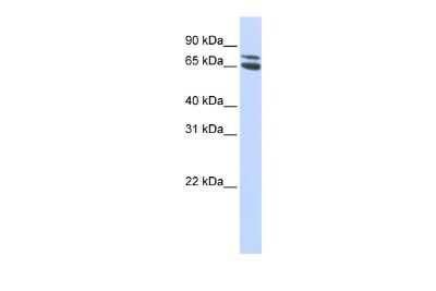 Western Blot: ZBTB48 Antibody [NBP2-88609] - WB Suggested Anti-ZBTB48 Antibody Titration: 0.2-1 ug/ml. ELISA Titer: 1:312500. Positive Control: HepG2 cell lysate