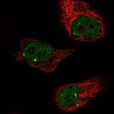 Immunocytochemistry/Immunofluorescence: ZBTB5 Antibody [NBP2-13536] - Staining of human cell line HeLa shows localization to nucleoplasm & nuclear bodies. Antibody staining is shown in green.