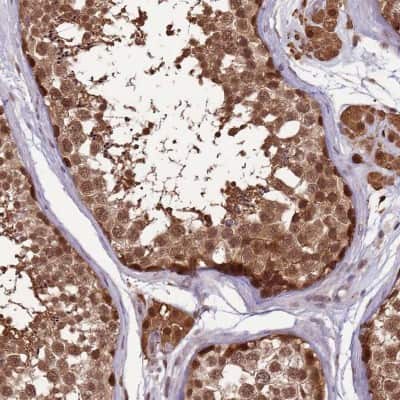 Immunohistochemistry-Paraffin: ZBTB5 Antibody [NBP2-13536] - Staining of human testis shows strong cytoplasmic and nuclear positivity in seminiferus ducts cells.