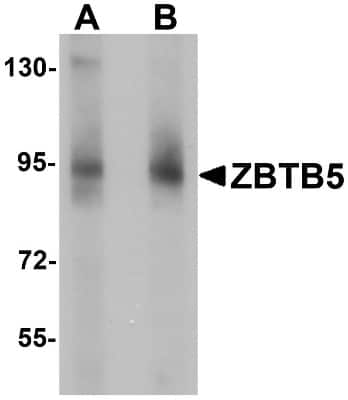 Western Blot: ZBTB5 Antibody [NBP1-76518] - Mouse brain tissue lysate with ZBTB5 antibody at (A) 1 and (B) 2 ug/mL.