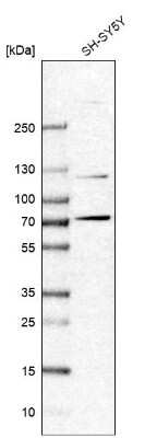 Western Blot: ZBTB5 Antibody [NBP2-13536] - Analysis in human cell line SH-SY5Y.