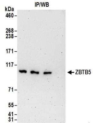 <b>Independent Antibodies Validation and Biological Strategies Validation.</b>Western Blot: ZBTB5 Antibody [NBP2-32099] - Western Blot: ZBTB5 Antibody [NBP2-32099] - Whole cell lysate (1 mg for IP; 20% of IP loaded) from Jurkat and cells.  Antibodies:  Affinity purified rabbit anti-ZBTB5 antibodyNBP2-32099 used for IP at 6 ug/mg lysate.  ZBTB5 was also immunoprecipitated by rabbit anti-ZBTB5 antibodies NBP2-32100 and NBP2-32101.  For blotting immunoprecipitated ZBTB5, NBP2-32099 was used at 1 ug/ml.  Detection: Chemiluminescence with an exposure time of 3 minutes.