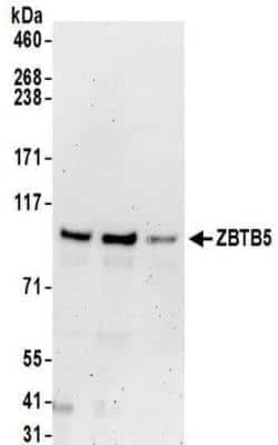 Western Blot: ZBTB5 Antibody [NBP2-32099] - Whole cell lysate (50 ug) from Jurkat, 293T, and HeLa cells.  Antibodies:  Affinity purified rabbit anti-ZBTB5 antibody NBP2-32099 used for WB at 0.1 ug/ml.  Detection: Chemiluminescence with an exposure time of 3 minutes.