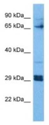 Western Blot: ZBTB5 Antibody [NBP3-09993] - Western blot analysis of ZBTB5 in Human 293T Whole Cell. Antibody dilution at 1.0ug/ml