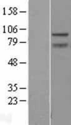 Western Blot: ZBTB5 Overexpression Lysate (Adult Normal) [NBL1-17976] Left-Empty vector transfected control cell lysate (HEK293 cell lysate); Right -Over-expression Lysate for ZBTB5.