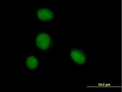 Immunocytochemistry/Immunofluorescence: ZBTB6 Antibody [H00010773-B01P] - Analysis of purified antibody to ZBTB6 on HeLa cell. (antibody concentration 10 ug/ml)