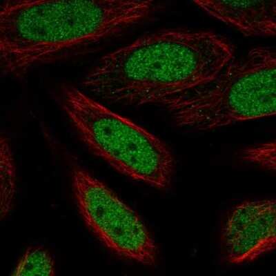 Immunocytochemistry/Immunofluorescence: ZBTB6 Antibody [NBP2-57411] - Staining of human cell line SiHa shows localization to nucleoplasm.