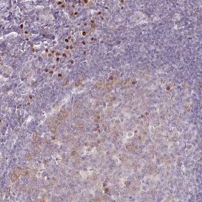 Immunohistochemistry: ZBTB6 Antibody [NBP2-49116] - Staining of human tonsil shows strong nuclear positivity in a subset of non-germinal center cells. Germinal center cells exhibited moderate cytoplasmic and nuclear staining in a fraction of cells.