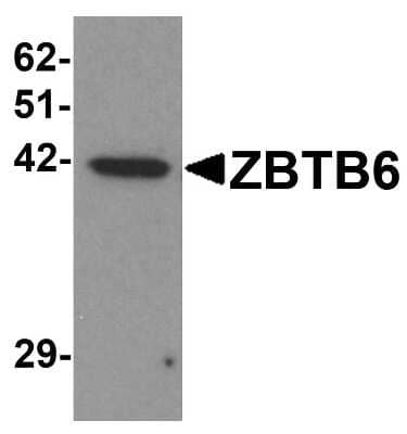 Western Blot ZBTB6 Antibody - BSA Free