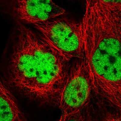 Immunocytochemistry/Immunofluorescence: ZBTB7A/Pokemon Antibody [NBP2-38550] - Staining  of human cell line A-431 shows positivity in nucleus but excluded from the nucleoli.