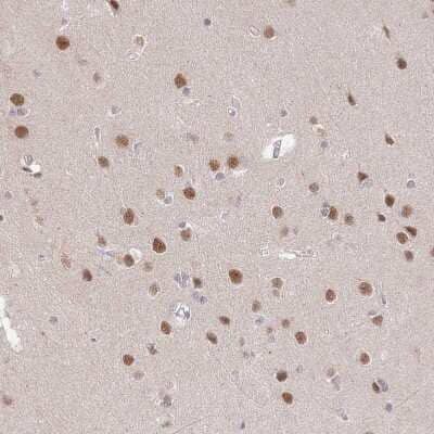 Immunohistochemistry-Paraffin: ZBTB7A/Pokemon Antibody [NBP2-38550] - Staining of human cerebral cortex shows strong nuclear positivity in neurons.