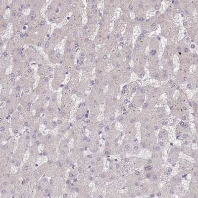 Immunohistochemistry-Paraffin: ZBTB7A/Pokemon Antibody [NBP2-38550] - Staining of human liver shows no positivity in hepatocytes as expected.