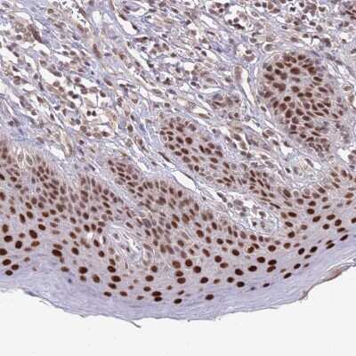 Immunohistochemistry-Paraffin: ZBTB7A/Pokemon Antibody [NBP2-38550] - Staining of human skin shows strong nuclear positivity in squamous epithelial cells.