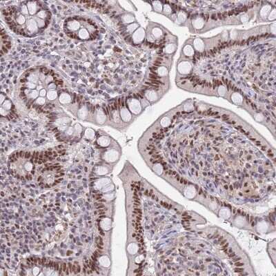Immunohistochemistry-Paraffin: ZBTB7A/Pokemon Antibody [NBP2-38550] - Staining of human small intestine shows strong nuclear positivity in glandular cells.