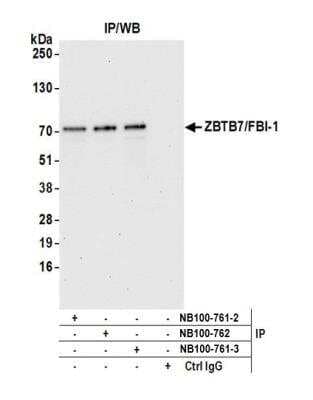 <b>Independent Antibodies Validation. </b>Immunoprecipitation: ZBTB7A/Pokemon Antibody [NB100-761] - Detection of human ZBTB7/FBI-1 by western blot of immunoprecipitates. Samples: Whole cell lysate (1.0 mg per IP reaction; 20% of IP loaded) from HeLa cells prepared using NETN lysis buffer. Antibodies: Affinity purified rabbit anti-ZBTB7/FBI-1 antibody NB100-761 (lot NB100-761-3) used for IP at 3 ug per reaction. ZBTB7/FBI-1 was also immunoprecipitated by a previous lot of this antibody (lot NB100-761-2) and rabbit anti-ZBTB7/FBI-1 antibody NB100-762. For blotting immunoprecipitated ZBTB7/FBI-1, NB100-761 was used at 1 ug/ml. Detection: Chemiluminescence with an exposure time of 30 seconds.