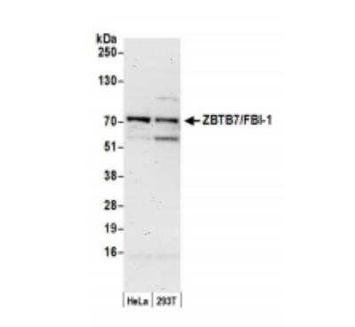 Western Blot: ZBTB7A/Pokemon Antibody [NB100-761] - Whole cell lysate (50 ug) from HeLa and HEK293T cells prepared using NETN lysis buffer. Antibody: Affinity purified rabbit anti-ZBTB7/FBI-1 antibody used for WB at 0.1 ug/ml. Detection: Chemiluminescence with an exposure time of 3 minutes.