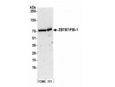 Western Blot: ZBTB7A/Pokemon Antibody [NB100-761] - Whole cell lysate (50 ug) from TCMK-1 and NIH 3T3 cells prepared using NETN lysis buffer. Antibody: Affinity purified rabbit anti-ZBTB7/FBI-1 antibody used for WB at 0.1 ug/ml. Detection: Chemiluminescence with an exposure time of 3 minutes.