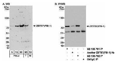 Western Blot: ZBTB7A/Pokemon Antibody [NB100-762] - Detection of Human ZBTB7(FBI-1) on HeLa whole cell lysate using NB100-762. ZBTB7(FBI-1) was also immunoprecipitated using rabbit antibodies NB100-761 and another ZBTB7(FBI-1) Ab.
