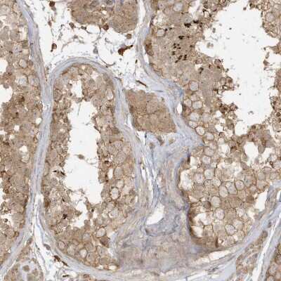 Immunohistochemistry-Paraffin: ZBTB8A Antibody [NBP2-48618] - Staining of human testis shows moderate cytoplasmic and membranous positivity in cells in seminiferus ducts with distinct staining of acrosomal caps.