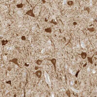 Immunohistochemistry-Paraffin: ZBTB8A Antibody [NBP2-48619] - Staining of human cerebral cortex shows strong cytoplasmic positivity in glial cells.
