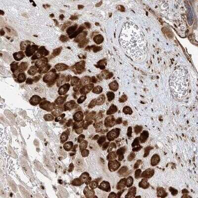 Immunohistochemistry-Paraffin: ZBTB8A Antibody [NBP1-88375] - Staining of human placenta shows strong cytoplasmic and nucleolar positivity in decidua cells.