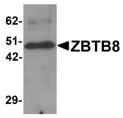 Western Blot ZBTB8A Antibody - BSA Free