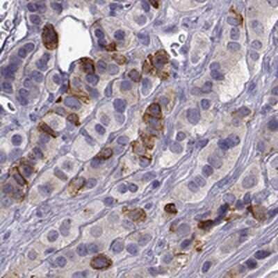 Immunohistochemistry-Paraffin: ZBTB8B Antibody [NBP2-46826] - Staining of human anterior pituitary gland shows strong cytoplasmic and membranous positivity in endocrine cells.