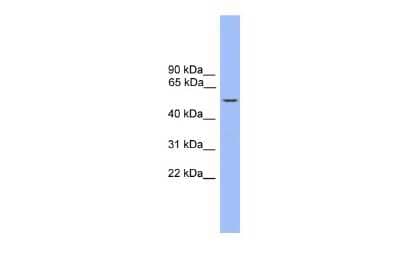 Western Blot: ZBTB8B Antibody [NBP2-83788] - WB Suggested Anti-ZBTB8 Antibody Titration: 0.2-1 ug/ml. Positive Control: THP-1 cell lysate