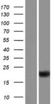 Western Blot: ZBTB8OS Overexpression Lysate (Adult Normal) [NBP2-04962] Left-Empty vector transfected control cell lysate (HEK293 cell lysate); Right -Over-expression Lysate for ZBTB8OS.