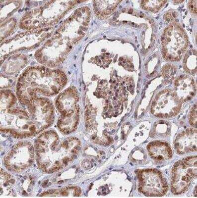 Immunohistochemistry-Paraffin: ZC3H10 Antibody [NBP1-82233] - Staining of human kidney shows moderate cytoplasmic positivity in tubule cells.