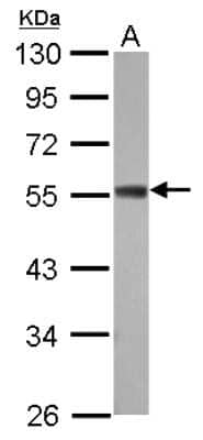 Western Blot: ZC3H10 Antibody [NBP2-20938] - Sample (30 ug of whole cell lysate) A: 293T 10% SDS PAGE gel, diluted at 1:1000.