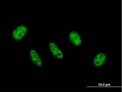 Immunocytochemistry/Immunofluorescence: ZC3H11A Antibody [H00009877-B01P] - Analysis of purified antibody to ZC3H11A on HeLa cell. (antibody concentration 10 ug/ml)